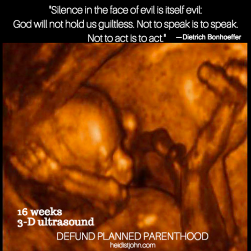 Speak for those who cannot speak for themselves. Defund Planned Parenthood. Every life matters.